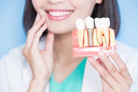 Woman holding up model of dental implants and smiling