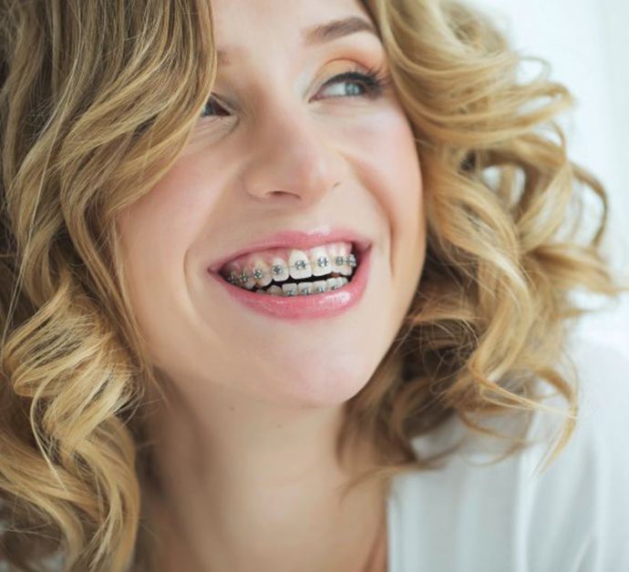 a woman smiling while wearing metal braces