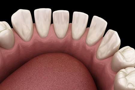 a 3D illustration of gapped teeth